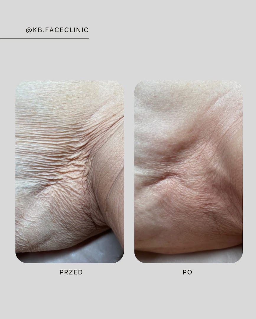 KB Face Clinic Kasandra Badowska - Kosmetolog Nowa Sól · Zdjęcia 3
