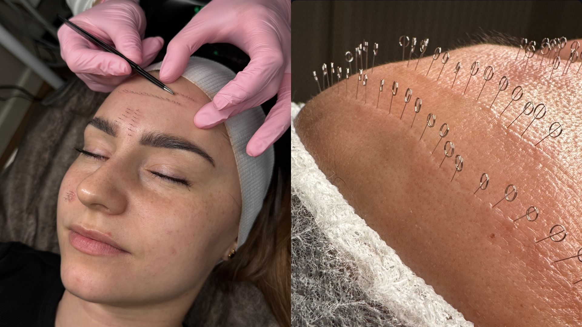 KB Face Clinic Kasandra Badowska - Kosmetolog Nowa Sól · Zdjęcia 1